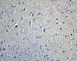 DCLK1 Polyclonal Antibody:Antibodies, Polyclonal