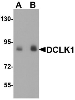 DCLK1 Polyclonal Antibody:Antibodies, Polyclonal