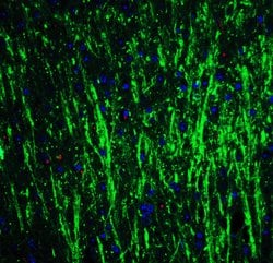 Invitrogen DCLK3 Polyclonal Antibody 100 &mu;g; Unconjugated:Antibodies,