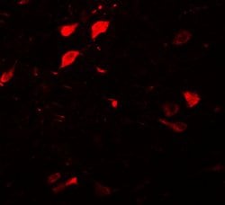 Invitrogen DCLK3 Polyclonal Antibody 100 &mu;g; Unconjugated:Antibodies,