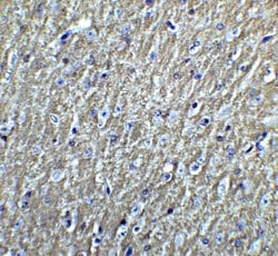 Invitrogen DCLK3 Polyclonal Antibody 100 &mu;g; Unconjugated:Antibodies,