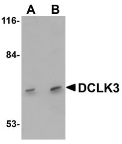 Invitrogen DCLK3 Polyclonal Antibody 100 &mu;g; Unconjugated:Antibodies,
