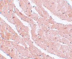 CAZIP Polyclonal Antibody:Antibodies, Polyclonal