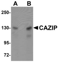 CAZIP Polyclonal Antibody:Antibodies, Polyclonal