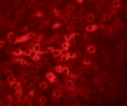 TMEM70 Polyclonal Antibody 100 &mu;g | Buy Online | Thermo Scientific | Fisher Scientific