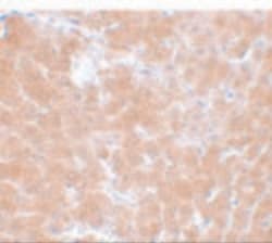 TMEM70 Polyclonal Antibody 100 &mu;g | Buy Online | Thermo Scientific | Fisher Scientific