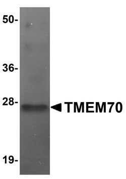 TMEM70 Polyclonal Antibody 100 &mu;g | Buy Online | Thermo Scientific | Fisher Scientific