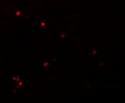 Invitrogen NDUFB9 Polyclonal Antibody 100 &mu;g; Unconjugated:Antibodies,