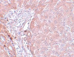 Invitrogen NDUFB9 Polyclonal Antibody 100 &mu;g; Unconjugated:Antibodies,