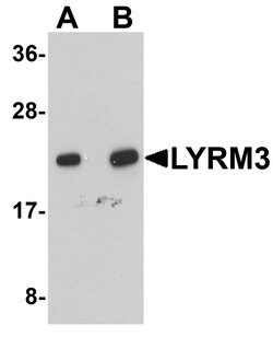 Invitrogen NDUFB9 Polyclonal Antibody 100 &mu;g; Unconjugated:Antibodies,