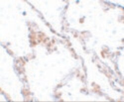 Invitrogen TMEM184B Polyclonal Antibody 100 &mu;g; Unconjugated:Antibodies,