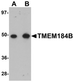Invitrogen TMEM184B Polyclonal Antibody 100 &mu;g; Unconjugated:Antibodies,