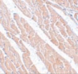 Invitrogen TMEM184C Polyclonal Antibody 100 &mu;g; Unconjugated:Antibodies