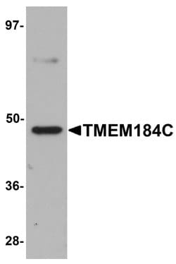 Invitrogen TMEM184C Polyclonal Antibody 100 &mu;g; Unconjugated:Antibodies