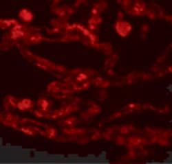 Invitrogen CCDC69 Polyclonal Antibody 100 &mu;g | Buy Online | Invitrogen&trade; | Fisher Scientific