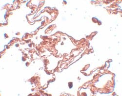 Invitrogen CCDC69 Polyclonal Antibody 100 &mu;g | Buy Online | Invitrogen&trade; | Fisher Scientific