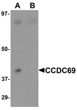 Invitrogen CCDC69 Polyclonal Antibody 100 &mu;g | Buy Online | Invitrogen&trade; | Fisher Scientific
