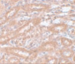 Invitrogen ENC1 Polyclonal Antibody 100 &mu;g; Unconjugated:Antibodies,