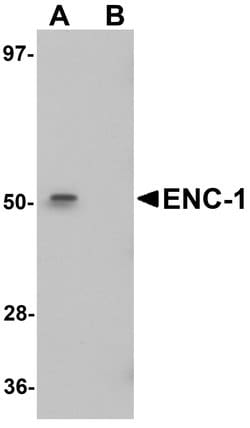 Invitrogen ENC1 Polyclonal Antibody 100 &mu;g; Unconjugated:Antibodies,