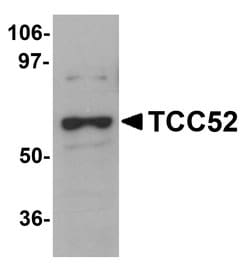 Invitrogen DCAF12 Polyclonal Antibody 100 &mu;g; Unconjugated:Antibodies,