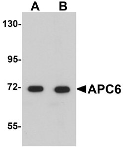 Invitrogen APC6 Polyclonal Antibody 100 &mu;g | Buy Online | Invitrogen&trade; | Fisher Scientific