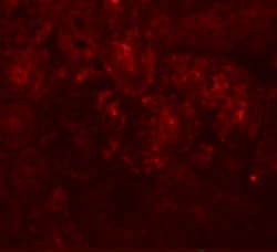Invitrogen PIAS1 Polyclonal Antibody 100 &mu;g; Unconjugated:Antibodies,