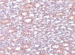 Invitrogen PIAS1 Polyclonal Antibody 100 &mu;g; Unconjugated:Antibodies,