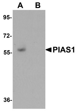 Invitrogen PIAS1 Polyclonal Antibody 100 &mu;g; Unconjugated:Antibodies,
