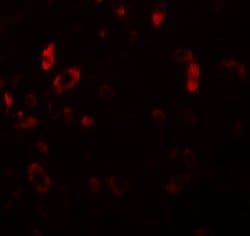 PIAS2 Polyclonal Antibody:Antibodies, Polyclonal