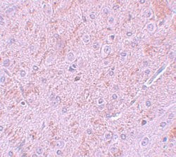 PIAS2 Polyclonal Antibody:Antibodies, Polyclonal