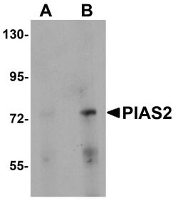 PIAS2 Polyclonal Antibody:Antibodies, Polyclonal
