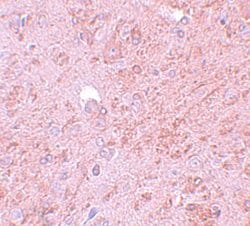 PIASy Polyclonal Antibody, Invitrogen 100 &mu;g; Unconjugated:Antibodies