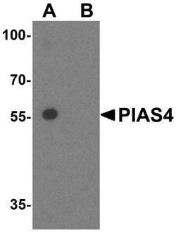 PIASy Polyclonal Antibody, Invitrogen 100 &mu;g; Unconjugated:Antibodies