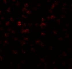 Invitrogen APC11 Polyclonal Antibody 100 &mu;g | Buy Online | Invitrogen&trade; | Fisher Scientific