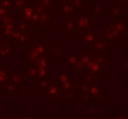 APC13 Polyclonal Antibody:Antibodies, Polyclonal