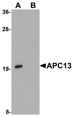 APC13 Polyclonal Antibody:Antibodies, Polyclonal