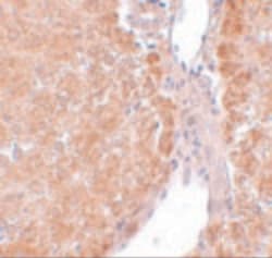 Invitrogen SUMO-3 Polyclonal Antibody 100 &mu;g | Buy Online | Invitrogen&trade; | Fisher Scientific
