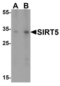 SIRT5 Polyclonal Antibody:Antibodies, Polyclonal