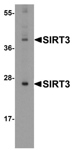 SIRT3 Polyclonal Antibody:Antibodies, Polyclonal