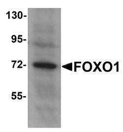 Invitrogen FOXO1 Polyclonal Antibody 100 &mu;g | Buy Online | Invitrogen&trade; | Fisher Scientific