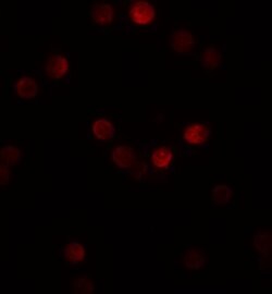 Invitrogen Gemin 2 Polyclonal Antibody 100 &mu;g | Buy Online | Invitrogen&trade; | Fisher Scientific