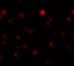 Invitrogen ZEB1 Polyclonal Antibody 100 &mu;g; Unconjugated:Antibodies,