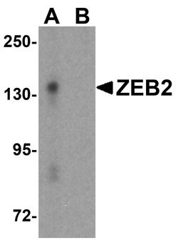 Invitrogen ZEB2 Polyclonal Antibody 100 &mu;g; Unconjugated:Antibodies,