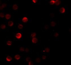 Invitrogen ZC3HAV1 Polyclonal Antibody 100 &mu;g; Unconjugated:Antibodies,