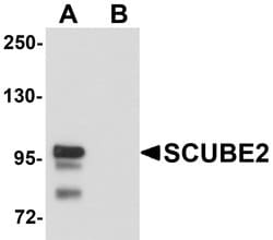 Invitrogen SCUBE2 Polyclonal Antibody 100 &mu;g; Unconjugated:Antibodies,