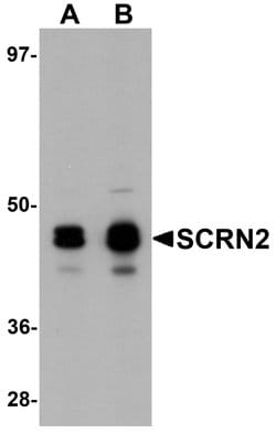Invitrogen SCRN2 Polyclonal Antibody 100 &mu;g; Unconjugated:Antibodies,