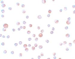 Invitrogen CABP7 Polyclonal Antibody 100 &mu;g | Buy Online | Invitrogen&trade; | Fisher Scientific