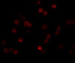 Invitrogen CABP7 Polyclonal Antibody 100 &mu;g | Buy Online | Invitrogen&trade; | Fisher Scientific