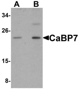 Invitrogen CABP7 Polyclonal Antibody 100 &mu;g | Buy Online | Invitrogen&trade; | Fisher Scientific
