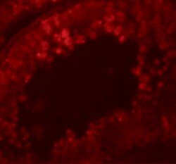 Invitrogen CRISP2 Polyclonal Antibody 100 &mu;g | Buy Online | Invitrogen&trade; | Fisher Scientific